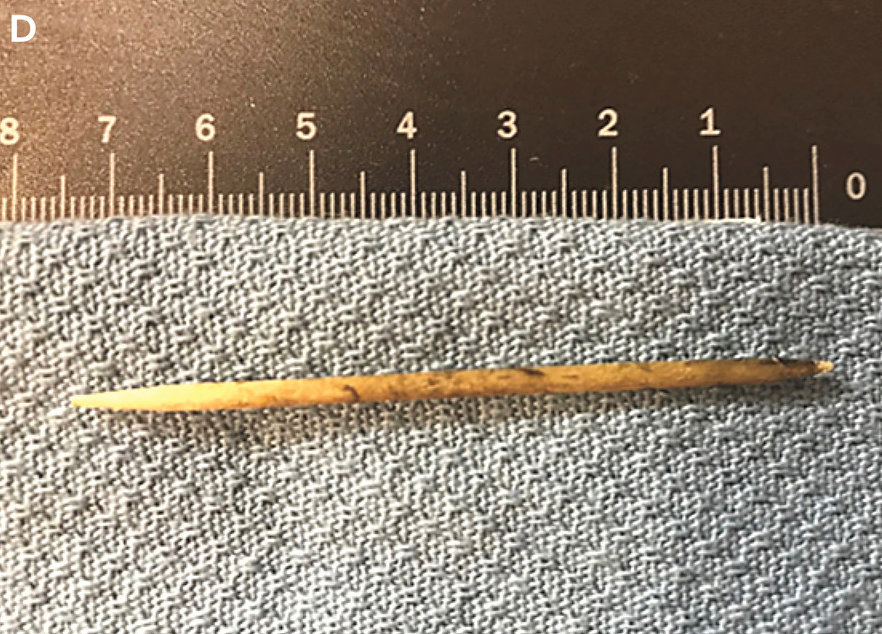 My Dog Swallowed a Toothpick What Should I Do?